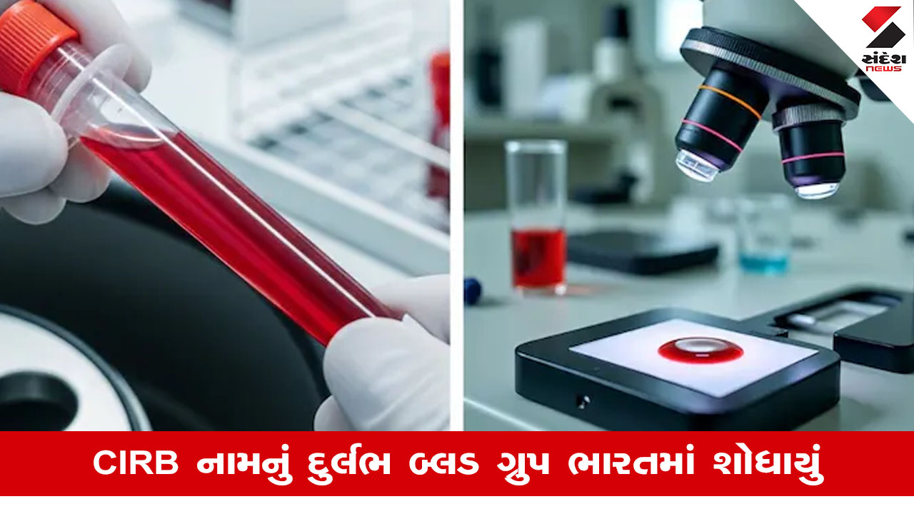 કર્ણાટકમાં મહિલા દર્દીમાં દુર્લભ બ્લડ ગ્રુપ 'CRIB' શોધાયું.