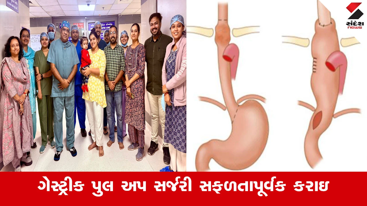 અમદાવાદ સિવિલ હોસ્પિટલમાં જટિલ ગેસ્ટ્રીક પુલ અપ સર્જરીથી બાળકના જીવનમાં આવ્યો ‘સ્વાદ’