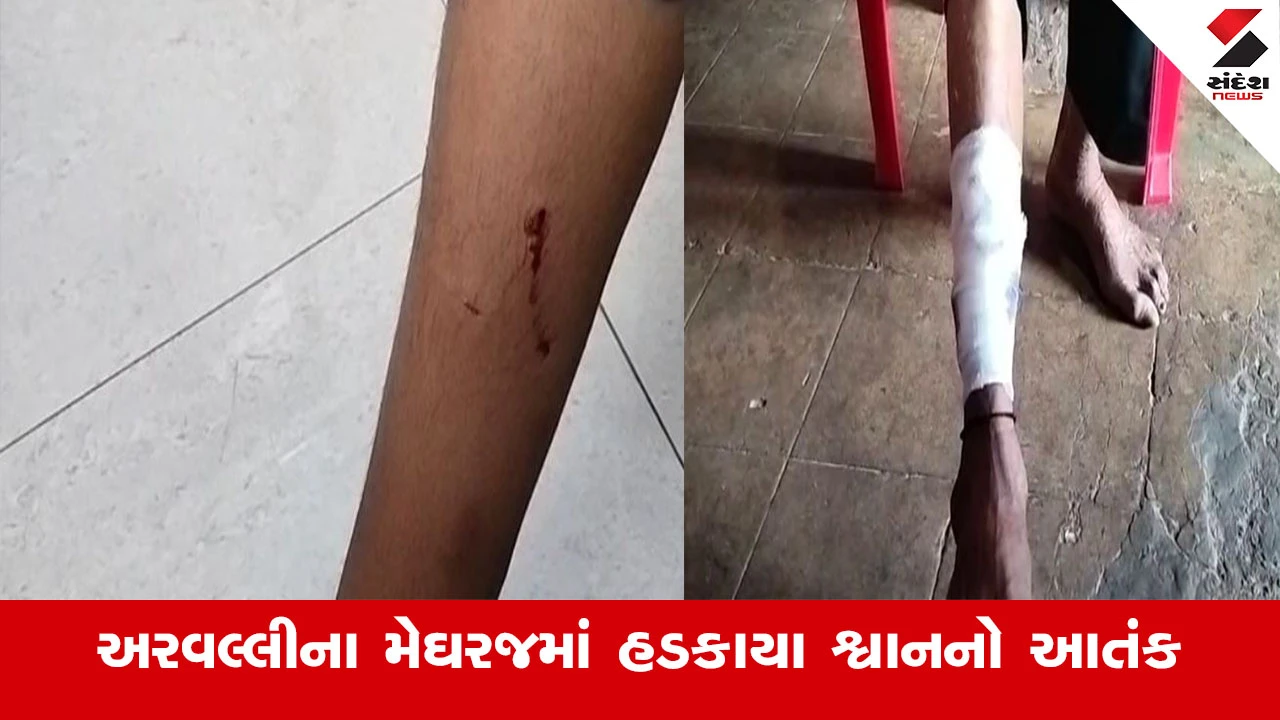 Arvalli News : અરવલ્લીના મેઘરજમાં હડકાયા શ્વાનનો આતંક, છેલ્લા બે દિવસમાં 30 લોકોને શ્વાને બચકા ભર્યા
