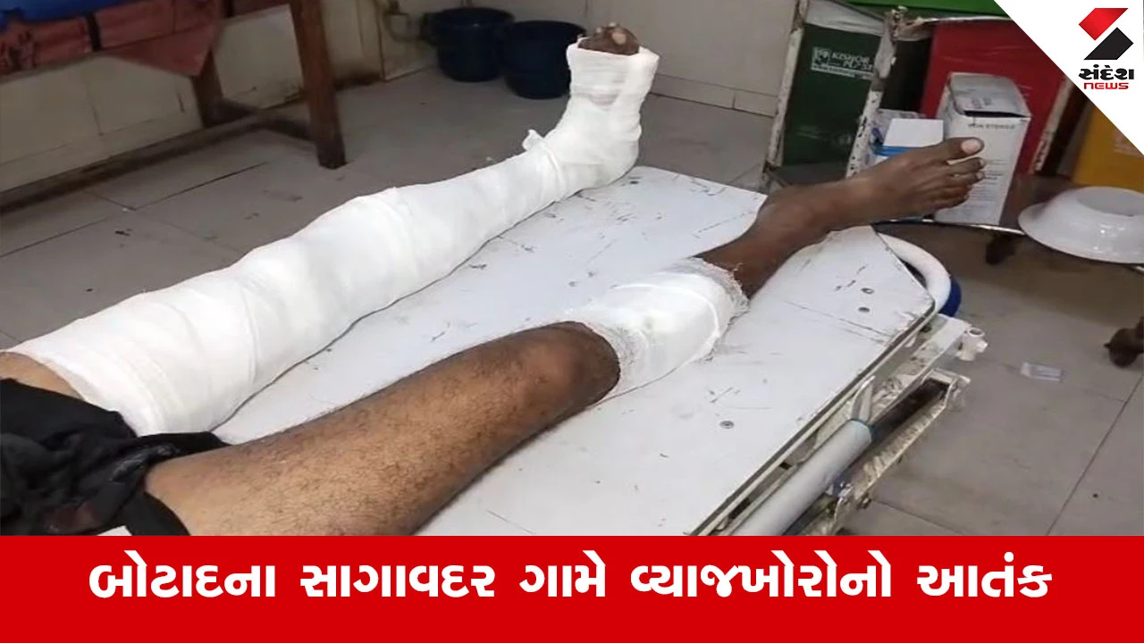 બોટાદના સાગાવદરમાં વ્યાજખોરોનો ત્રાસ, યુવકને લોખંડની પાઈપથી માર મારવામાં આવ્યો.
