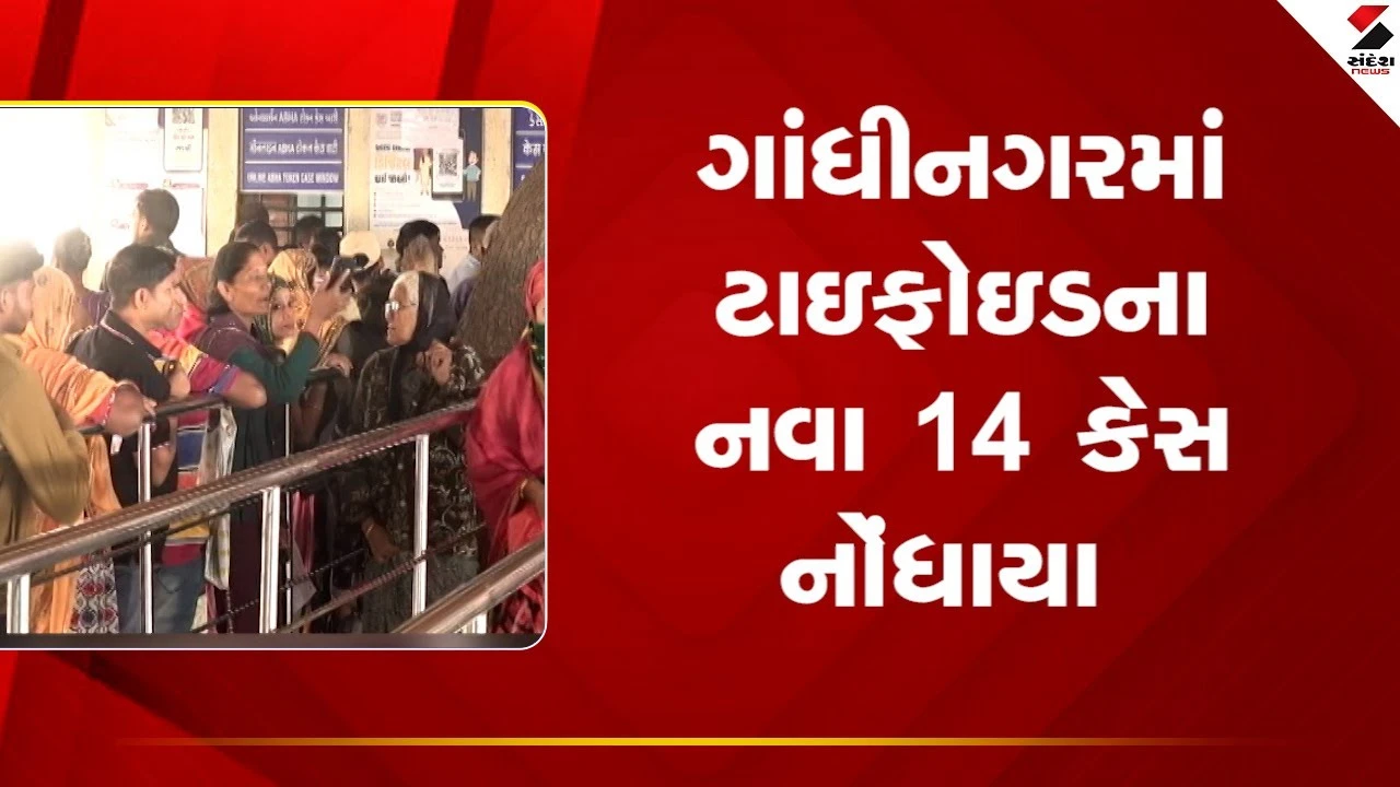 Gandhinagar: ગાંધીનગરમાં ટાઇફોઇડના નવા 14 કેસ નોંધાયા 