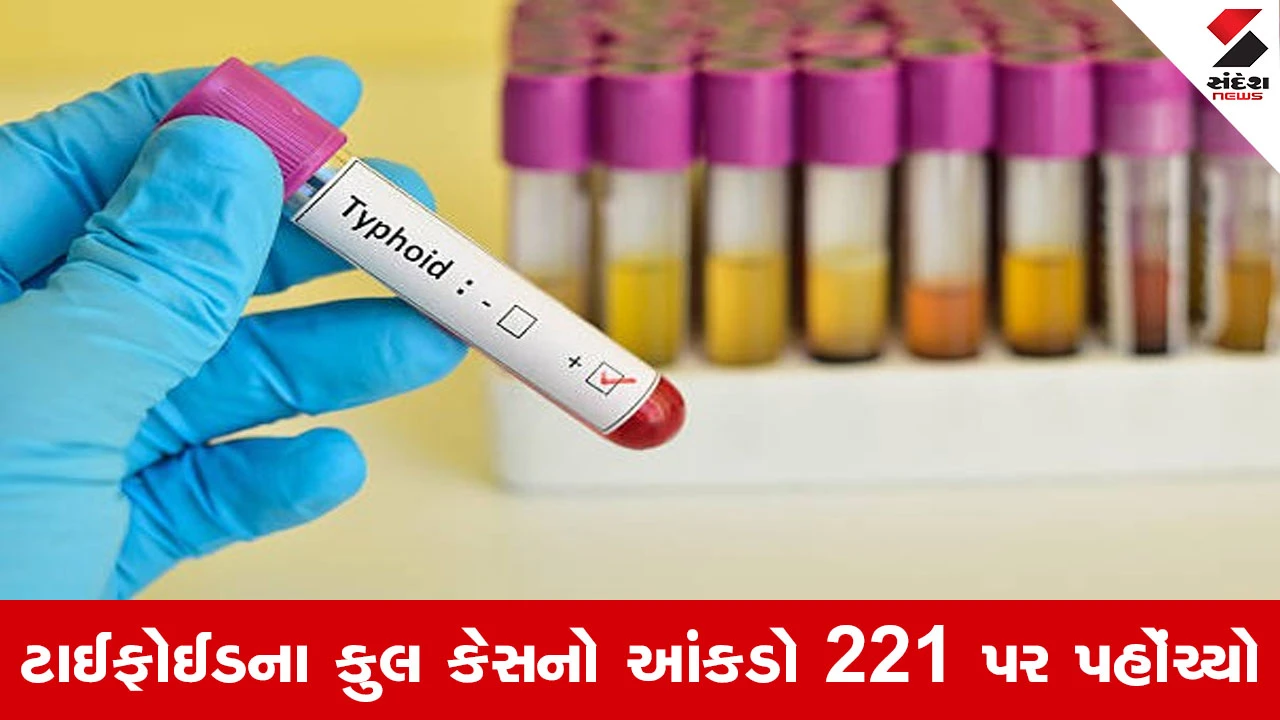 Gandhinagar માં ટાઈફોઈડનો હાહાકાર, 24 કલાકમાં ત્રણ નવા કેસ નોંધાતા તંત્ર દોડતું થયું 