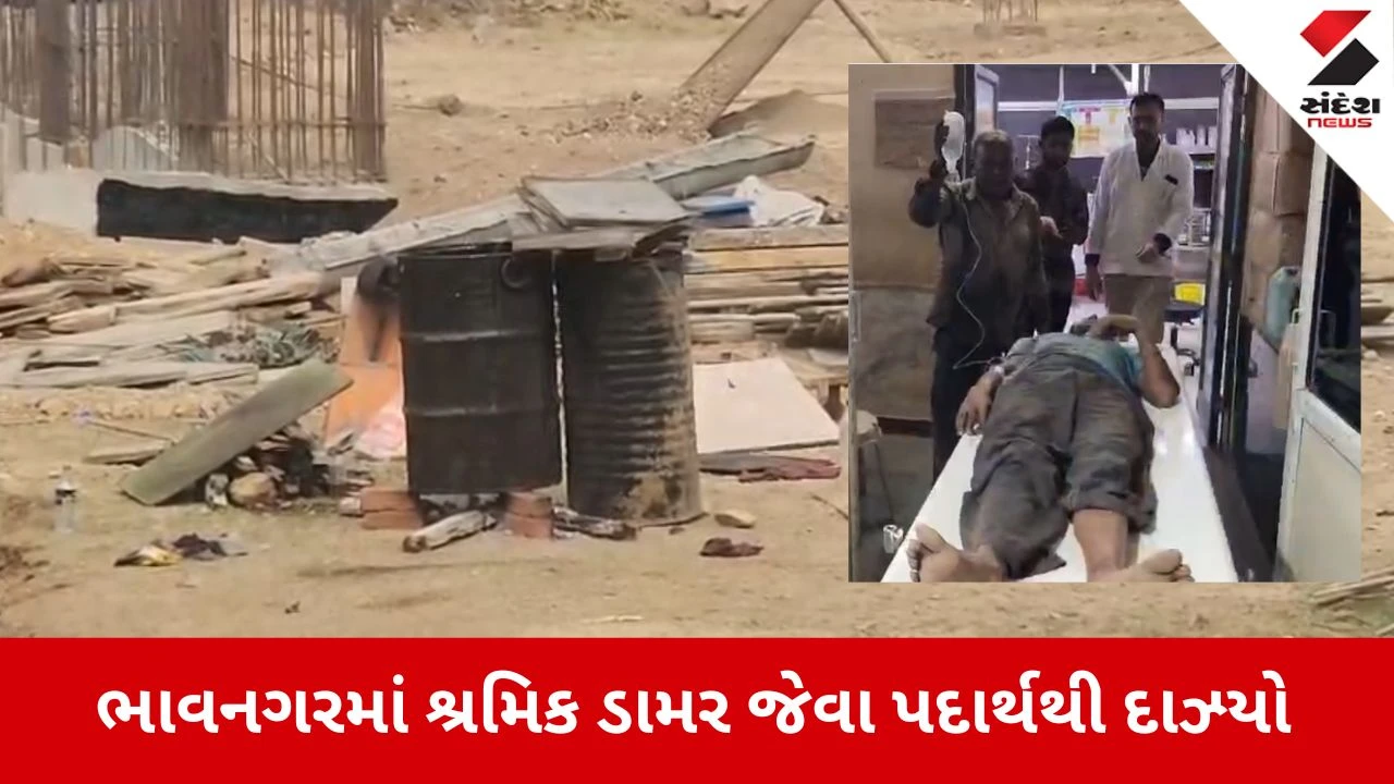 Bhavnagar News: ડામર જેવા પદાર્થથી દાઝ્યો મજૂર, હાલત ગંભીર 