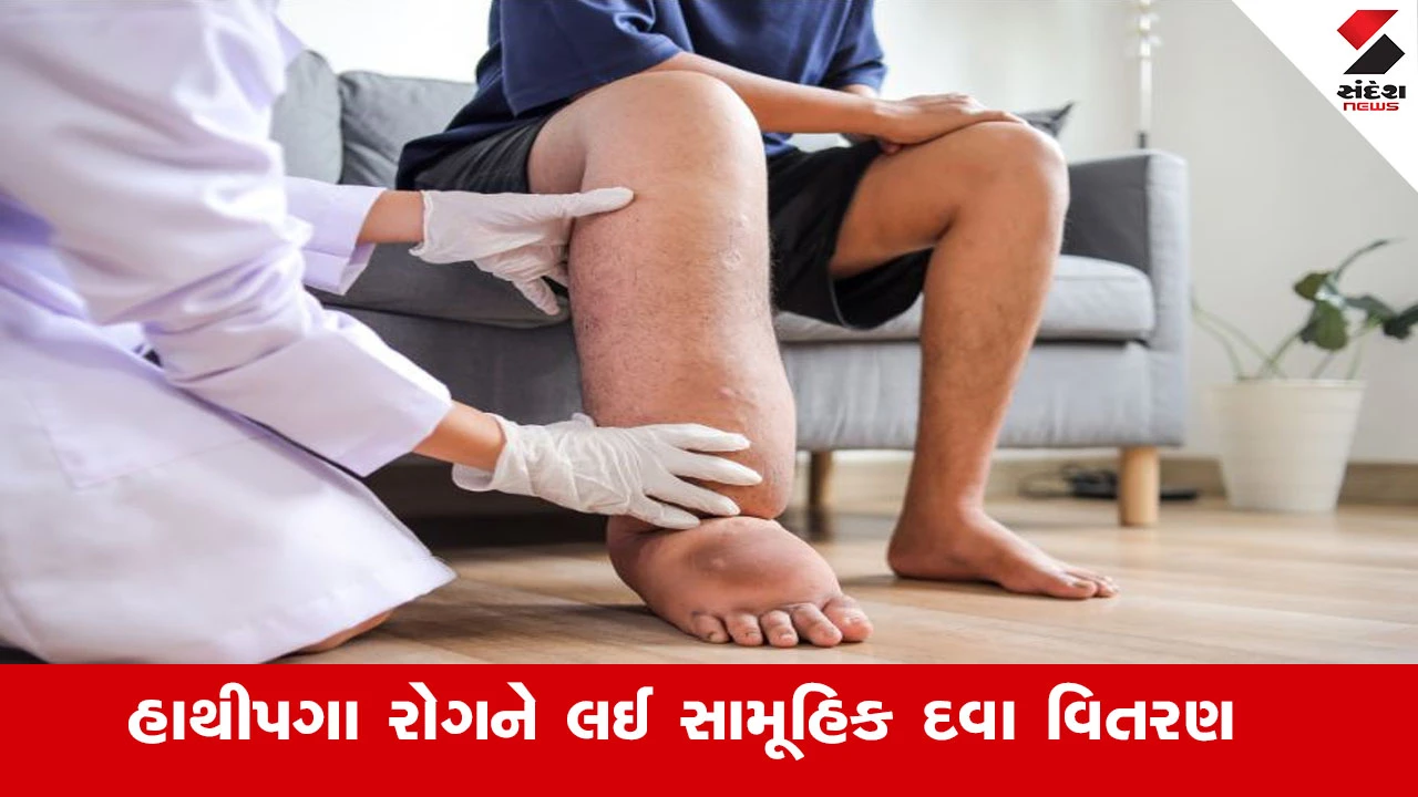 Gandhinagar News : દક્ષિણ ગુજરાતમાં 17 જિલ્લા હાથીપગા રોગ માટે સંવેદનશીલ છે, આવતીકાલથી સામૂહિક દવા વિતરણ કાર્યક્રમના ત્રીજા રાઉન્ડનો પ્રારંભ થશે 
