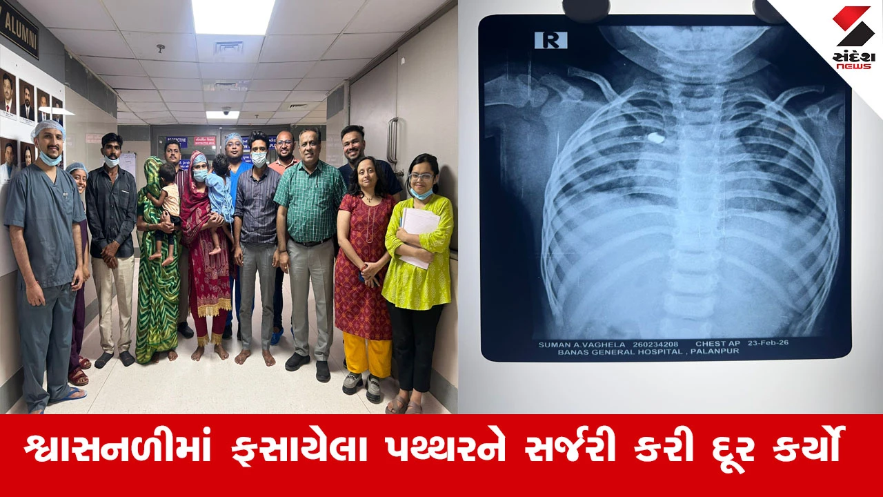 અમદાવાદ સિવિલ હોસ્પિટલે એરગન ગોળી અને પથ્થરથી પીડિત બાળકોને બચાવ્યા, ડોક્ટરોની માનવતા મહેકી.