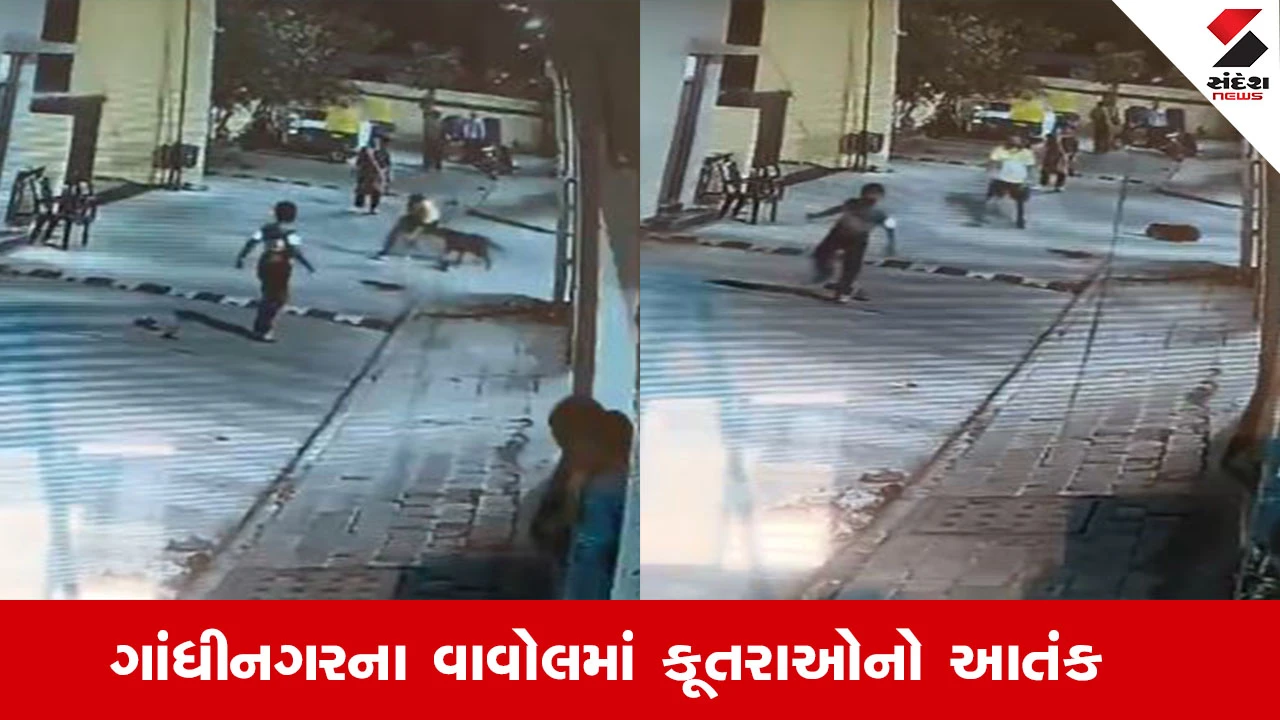 Gandhinagar News : ગાંધીનગરના વાવોલમાં કૂતરાએ ક્રિકેટ રમતા યુવકને ભર્યુ બચકુ, ગોકુલધામ સોસાયટીમાં કૂતરાઓનો આતંક
