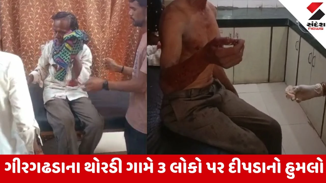Gir Somnath: થોરડી ગામે કેળાના બગીચામાં કામ કરતા કાકા-ભત્રીજા સહિત 3 લોકો પર દીપડાનો હુમલો 