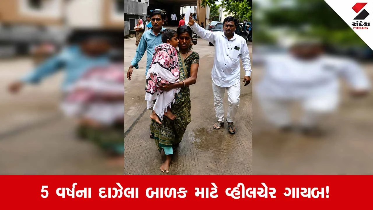 Vadodara SSG હોસ્પિટલમાં દાઝેલા બાળકને વ્હીલચેર-સ્ટ્રેચર પણ ન મળતા માતા ખોળામાં ઊંચકવા મજબૂર