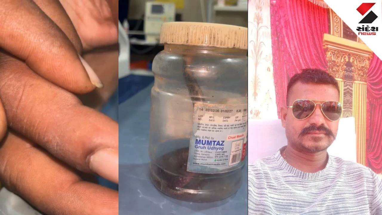 Vadodara News: Wildlife Rescuer Anil Machhi Dies of Cobra Bite in shinor