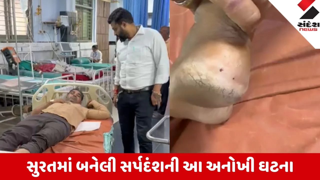 Surat: સાપના બે ડંખ બાદ આધેડે સાપને મારીને થેલીમાં પૂર્યો, સ્મીમેર હોસ્પિટલ પહોંચતા ડોક્ટરો ચોંક્યા