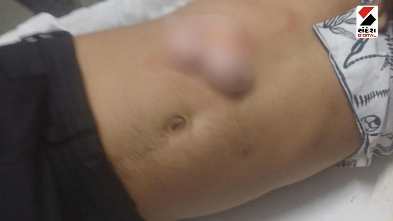 Gandhinagar News: Kalol Borisana Youth Murder: 20-Year-Old Stabbed to Death Over Love Affair Dispute