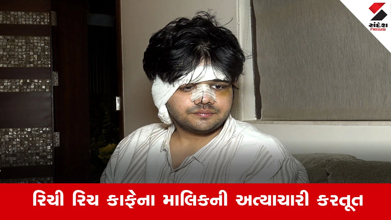 Ahmedabadમાં 'રિચી રિચ' કાફેના માલિક ભાવિક ગજ્જર દ્વારા યુવક પર હુમલો, પીડિત તનીશ પટેલનું નિવેદન સામે આવ્યું